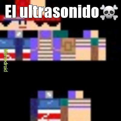 Mujer embarazada:que bonito esta mi bebé - meme