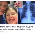 commented item thumbnail