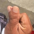 commented item thumbnail