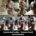 Forensic facial reconstruction
