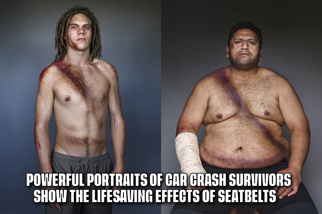 Powerful portraits of car crash survivors show the lifesaving effects of seatbelts - meme