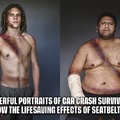 Powerful portraits of car crash survivors show the lifesaving effects of seatbelts