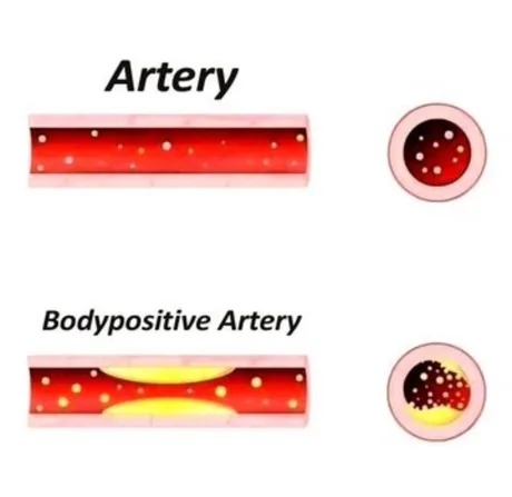 Body positive artery - meme