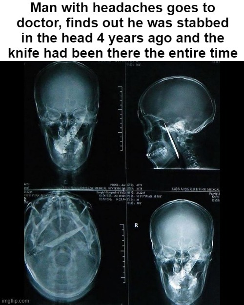 Check your headaches - meme