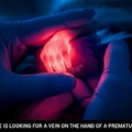 Premature Baby