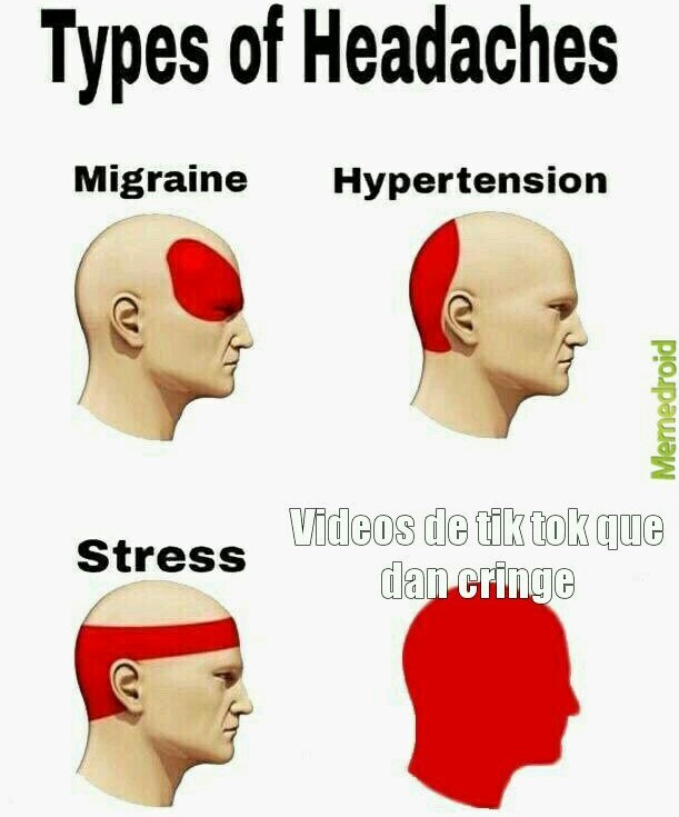 Tipos de dolores de cabeza - meme