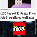 Lego can now break bones and heal them