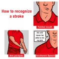How to recognize a stroke
