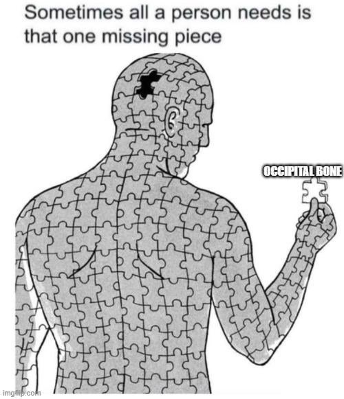 Sometimes all you’re missing is… an occipital bone - meme