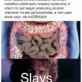 SLAVS