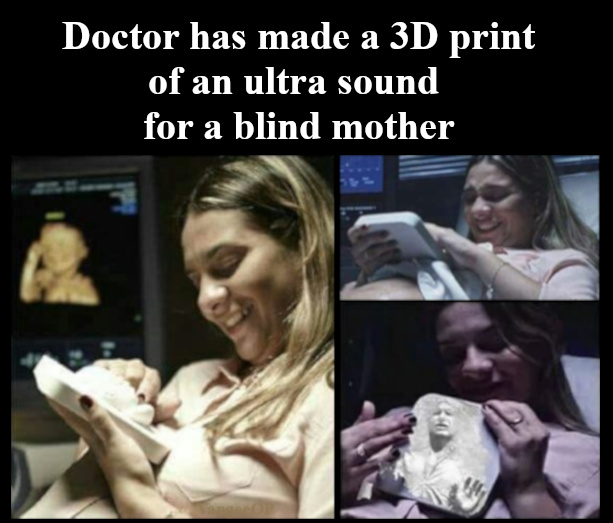 Doctor makes a 3D print of an ultra sound for a blind mother - meme