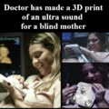 Doctor makes a 3D print of an ultra sound for a blind mother